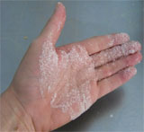 palm of hand with sugar